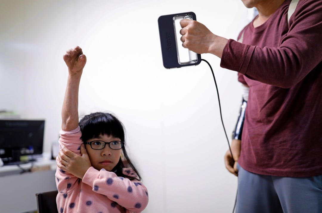 张宪良在量度Angel的右手。