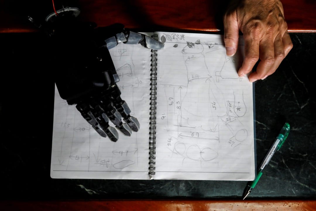 张宪良的笔记记录了有关Angel需要义肢的右手的情况和资料。