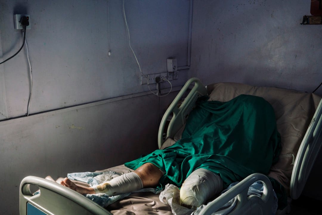 2018年12月13日，也門港口城市荷台達，25歲的Wafa Ahmed Hathim躺在醫院裏，她在一次迫擊砲襲擊中失去了左腳。