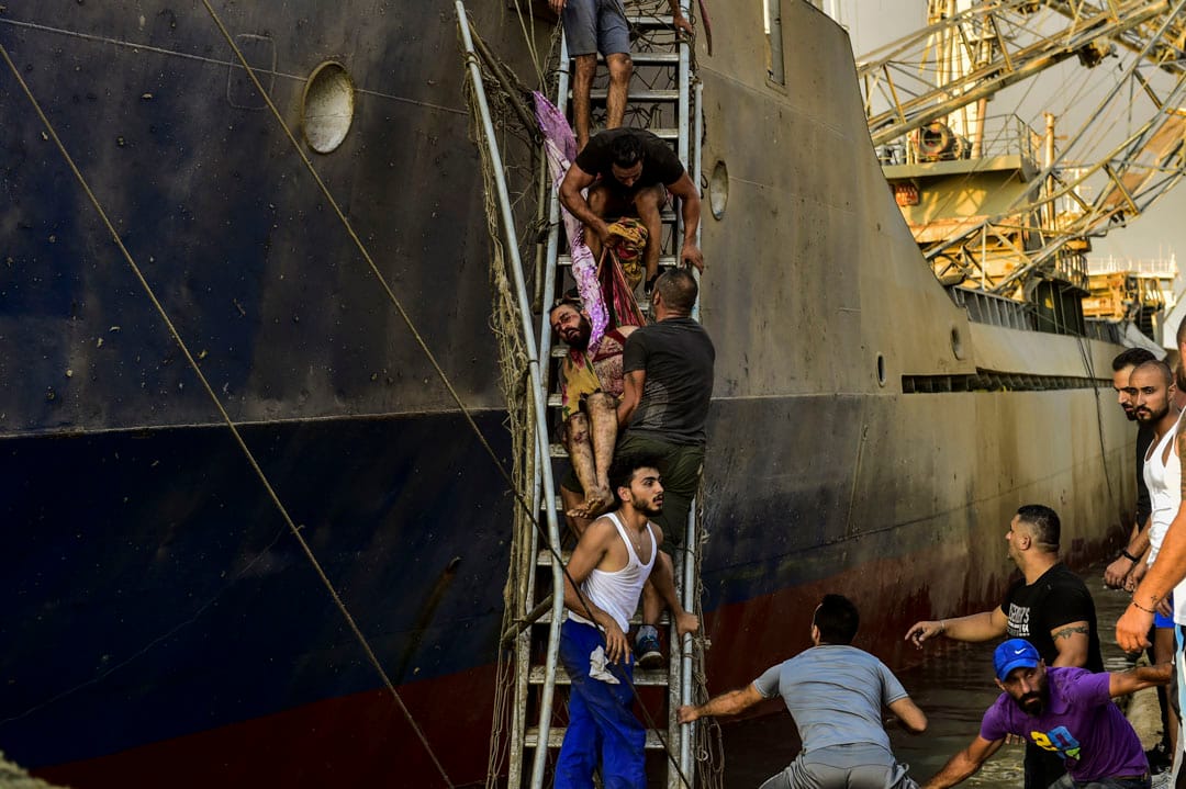 一名在爆炸中受伤的伤者被抬离现场。