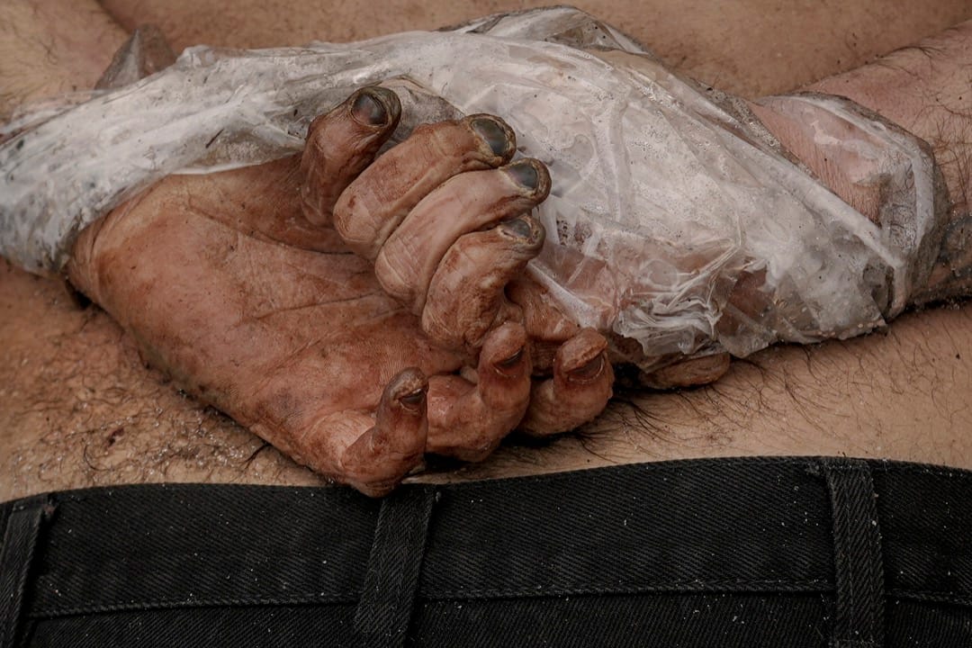 2022年4月3日,乌克兰城镇布查,一具双手被反绑在身后的男性尸体。