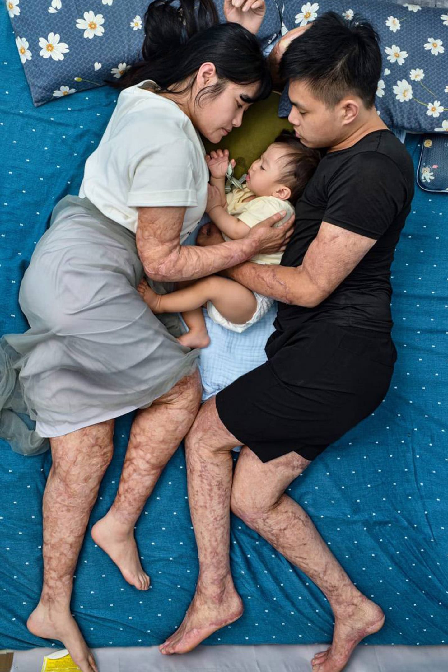 肖像類第二名。睡眠其實是人最接近死亡的狀態，對比生與死，浴火與重生，被火焰燒燙傷的夫妻懷中，即將滿周歲的兒子正一天天的成長茁壯。經歷八仙塵爆生死難關的兩個年輕人，復健之路讓他們身心煎熬，是彼此互相鼓勵讓他們決定好好活下去。順著生命走，意外留下的是，更強的挫折忍耐力。