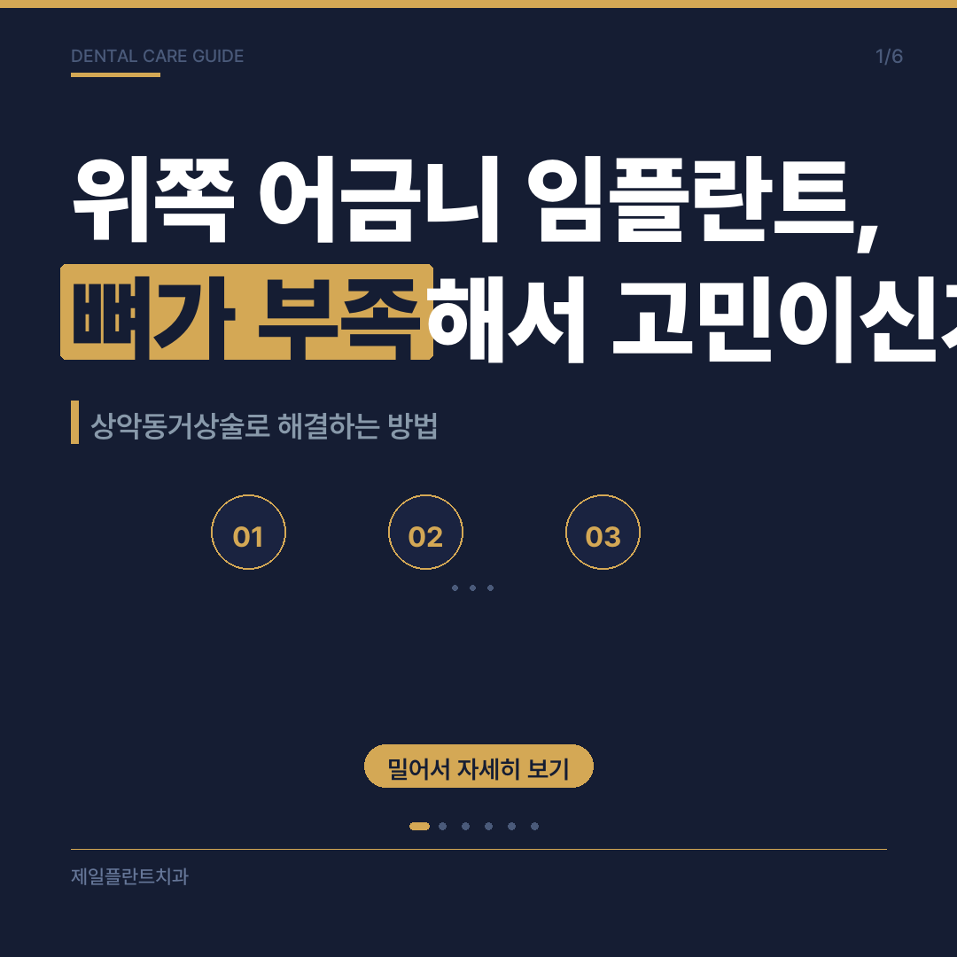 위쪽 어금니 임플란트 뼈 부족 문제 해결