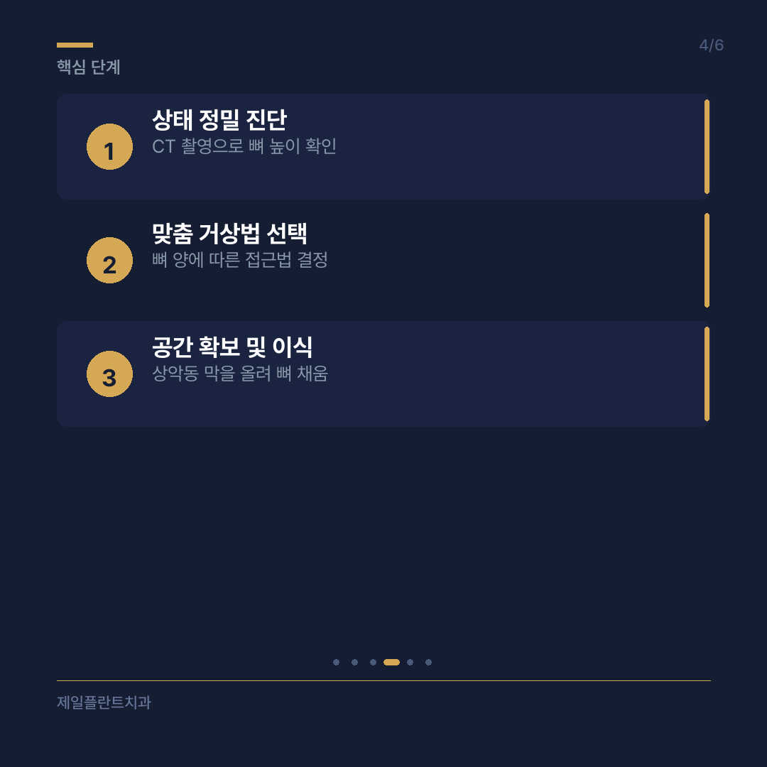 상악동거상술 방법 비교 및 선택 기준