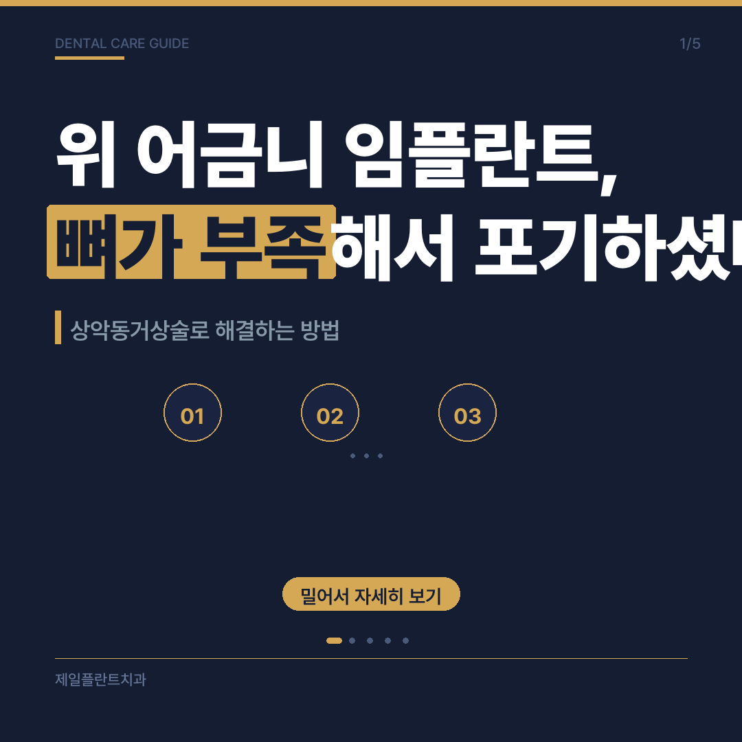 위 어금니 임플란트, 뼈가 부족해서 포기하셨나요?