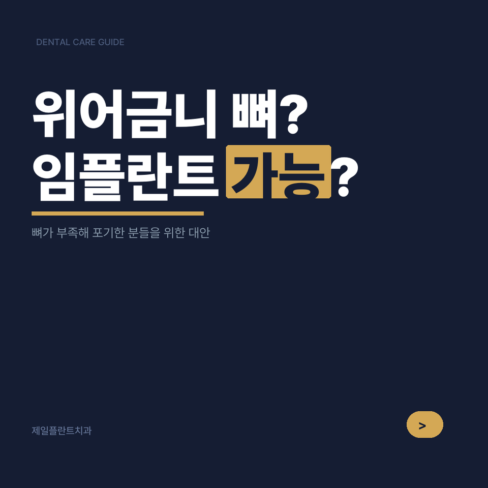 상악동거상술, 뼈가 얇아도 임플란트 가능할까? 강서구 실제 사례로 확인