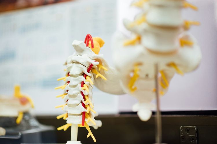 Brachial Neuritis and Me - 10 Lessons I Learned
