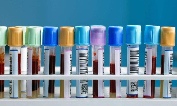 Dès le 10 février 2015, c'est dans l'ancien Des Laurentides Ford que sera situé le centre de prélèvements de l'Hôpital région