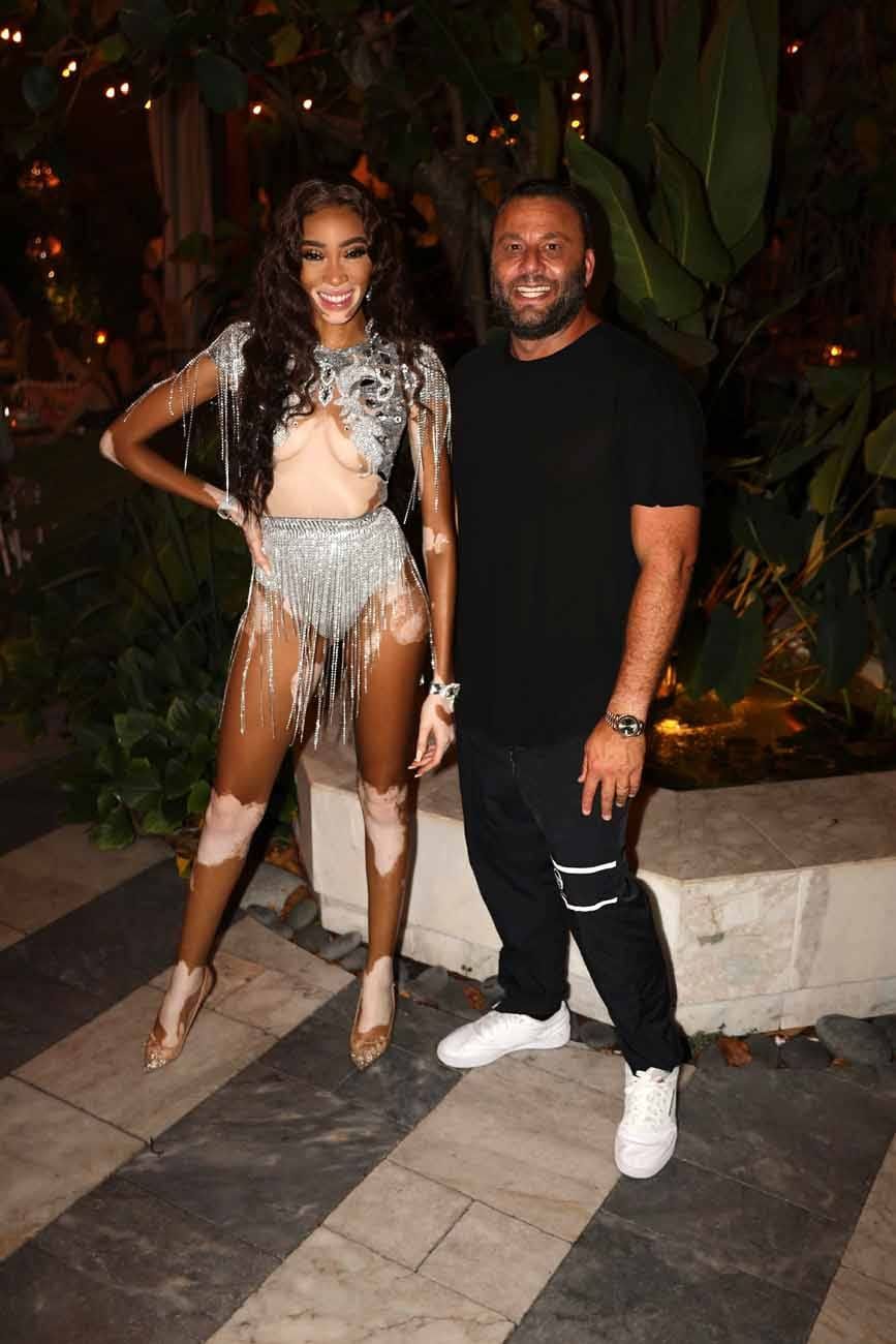 Winnie Harlow LOVES a Birthday in Her Birthday Suit