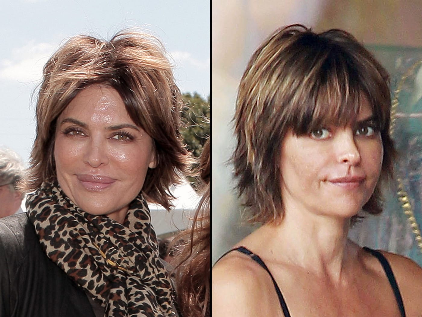 Fug or Fab the Surgery: Lisa Rinna