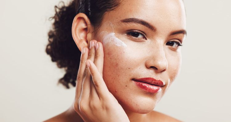 Your Ultimate Guide to Treating Acne Scars
