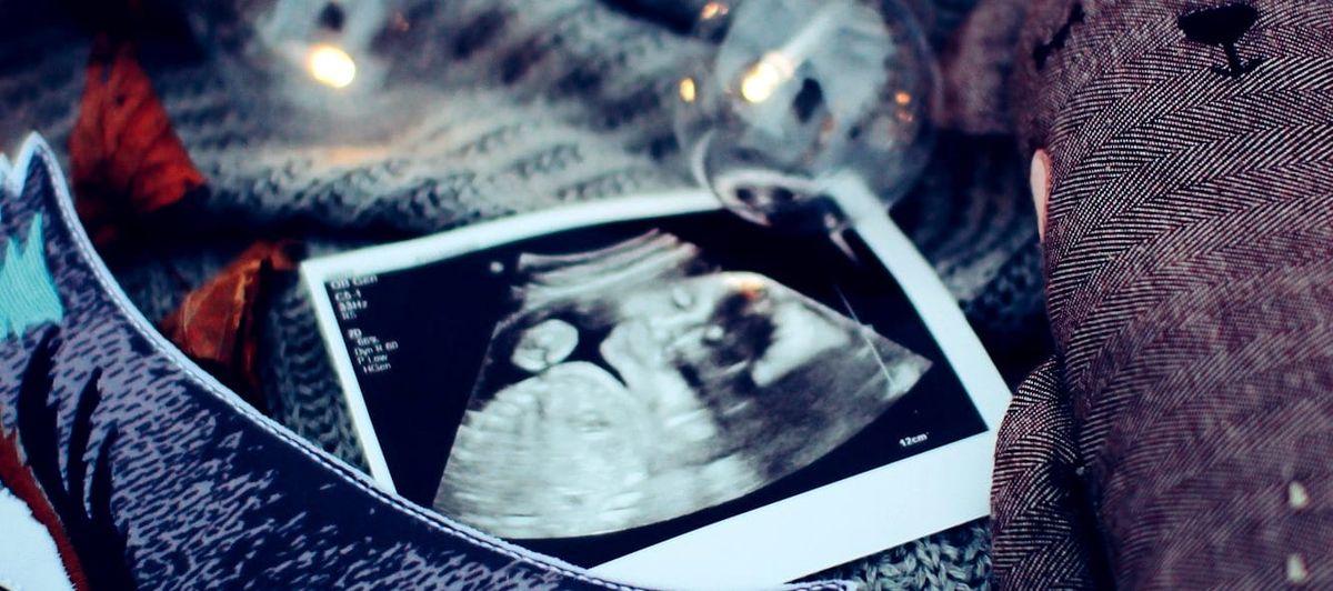 Obstetric & Gynecology Anesthesia