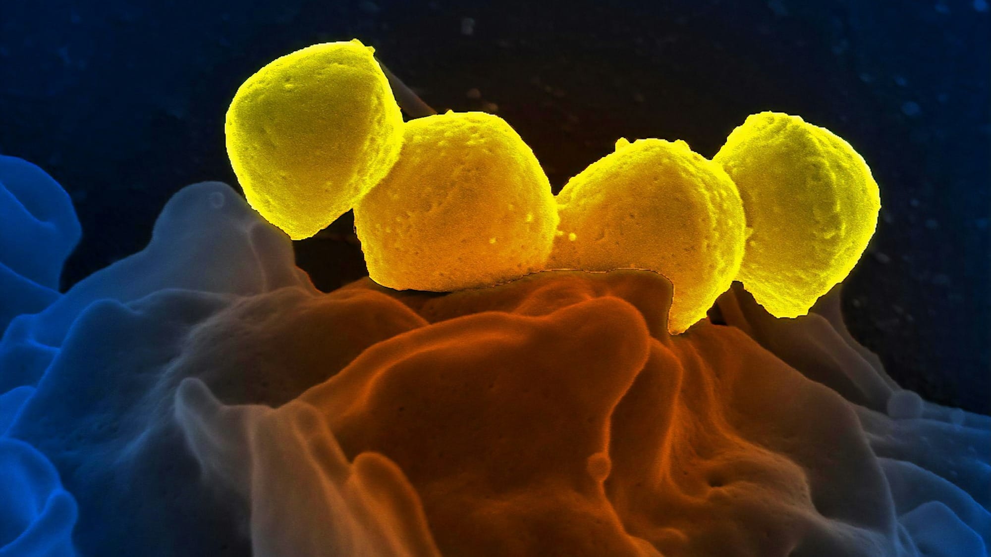 Multiply Labs uses robotics and NVIDIA simulation to scale cell therapy manufacturing