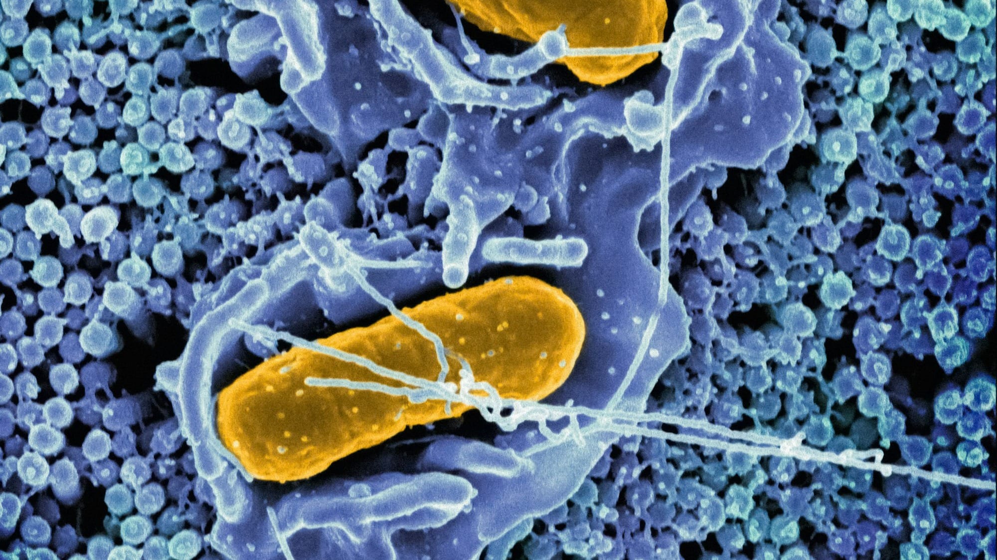 Injecting mitochondria from the young into the old