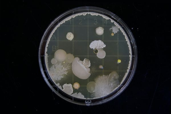 Mirror bacteria: the lab-made microbes scientists now fear could threaten all life on Earth post image