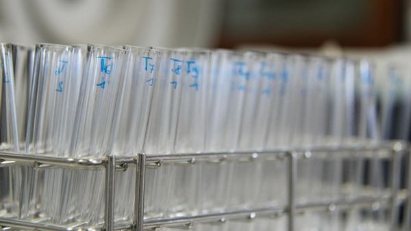 GLP-1 specialist Novo Nordisk's abandoned Parkinson's therapy finds a second life at a Zuckerberg-backed AI startup, exposing the costs of Big Pharma's obesity obsession post image
