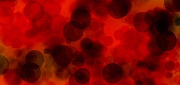 Blood Clots and Feet