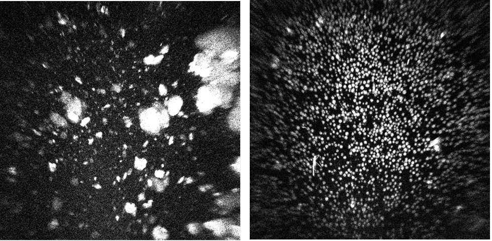 Merck's Keytruda Microgravity Crystallization