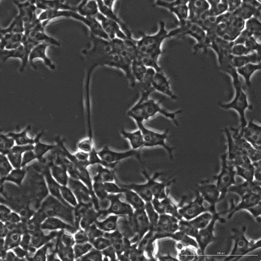 Human Cells Being Edited by OpenCRISPR-1 Designed Protein
