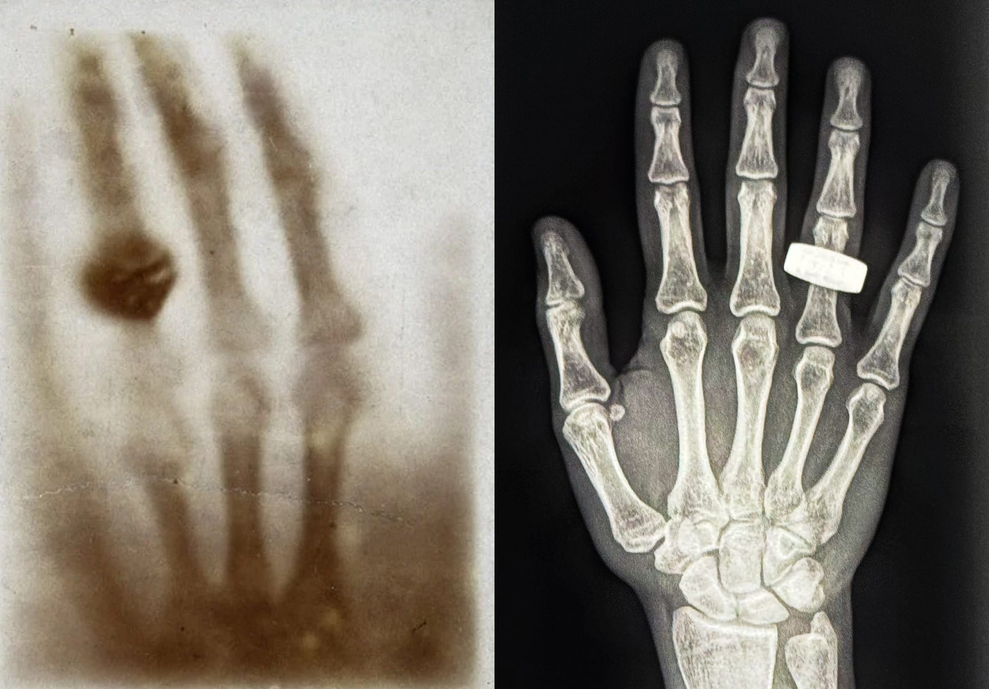 The world's first X-ray (left) and the first X-ray taken in space (right). ©SpaceX