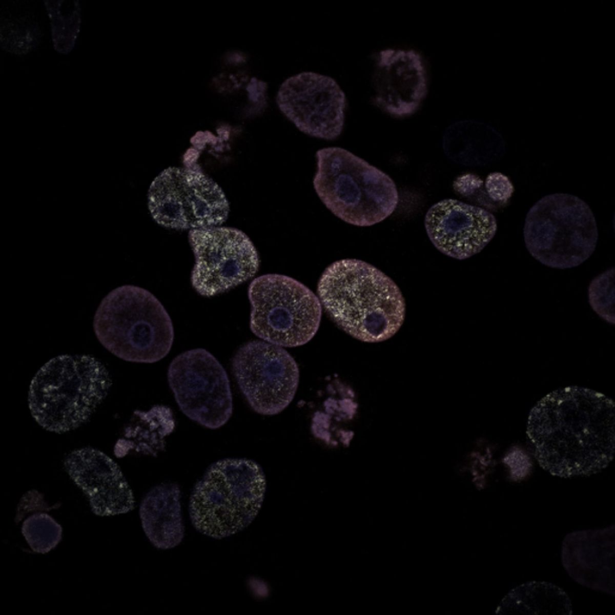 The Future of Immunotherapy