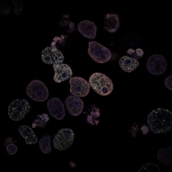 The Future of Immunotherapy