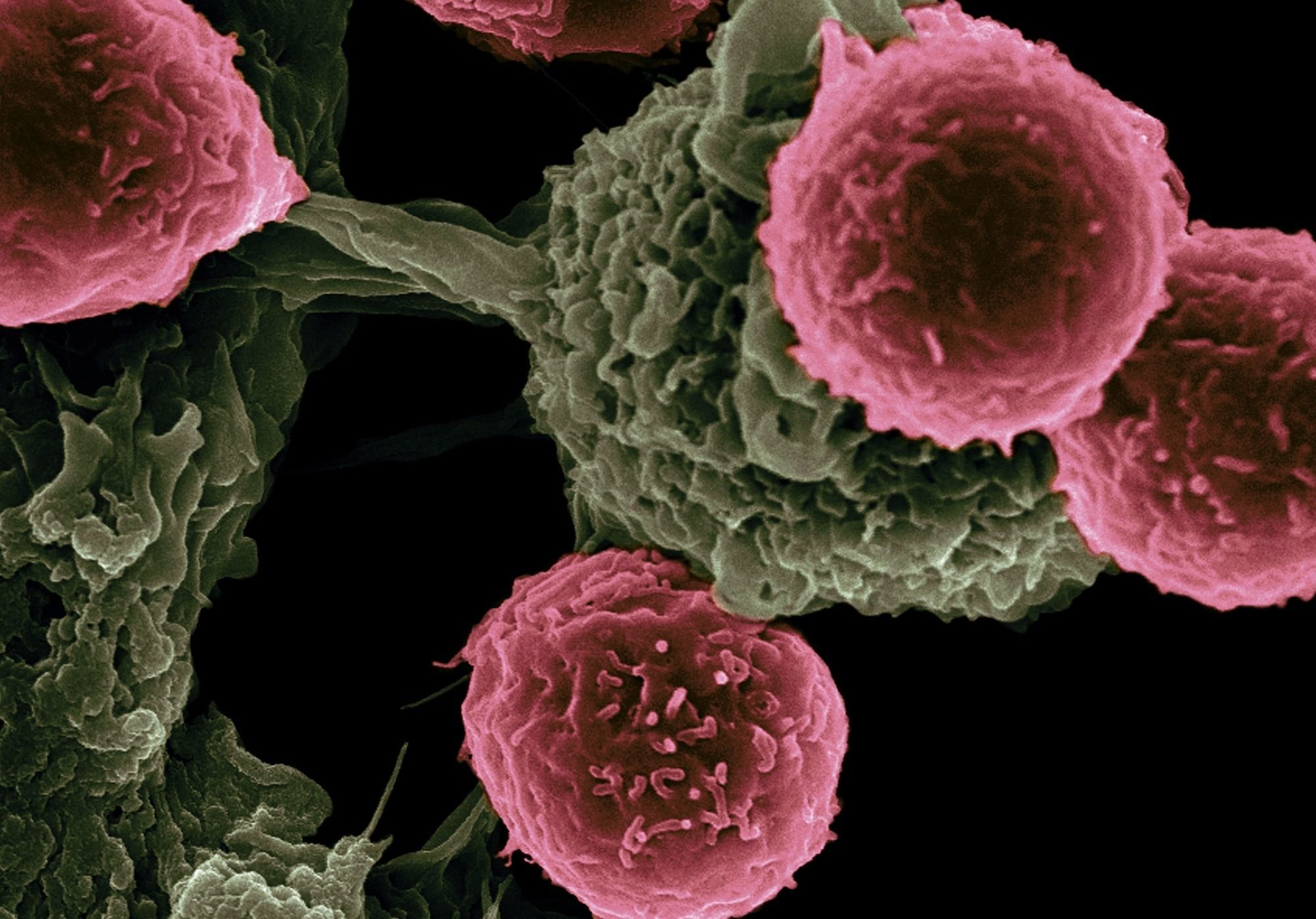 This Japanese Pharmaceutical Company Signed a $5.5 Billion Deal to Develop New Cancer Therapies Post feature image