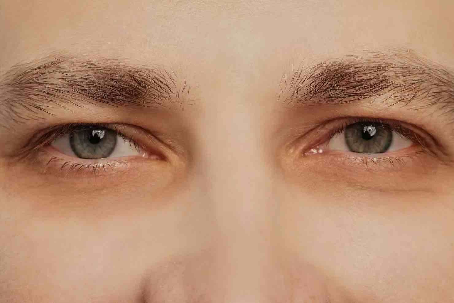Bolsas y ojeras en hombres: tips caseros para desinflamarlas