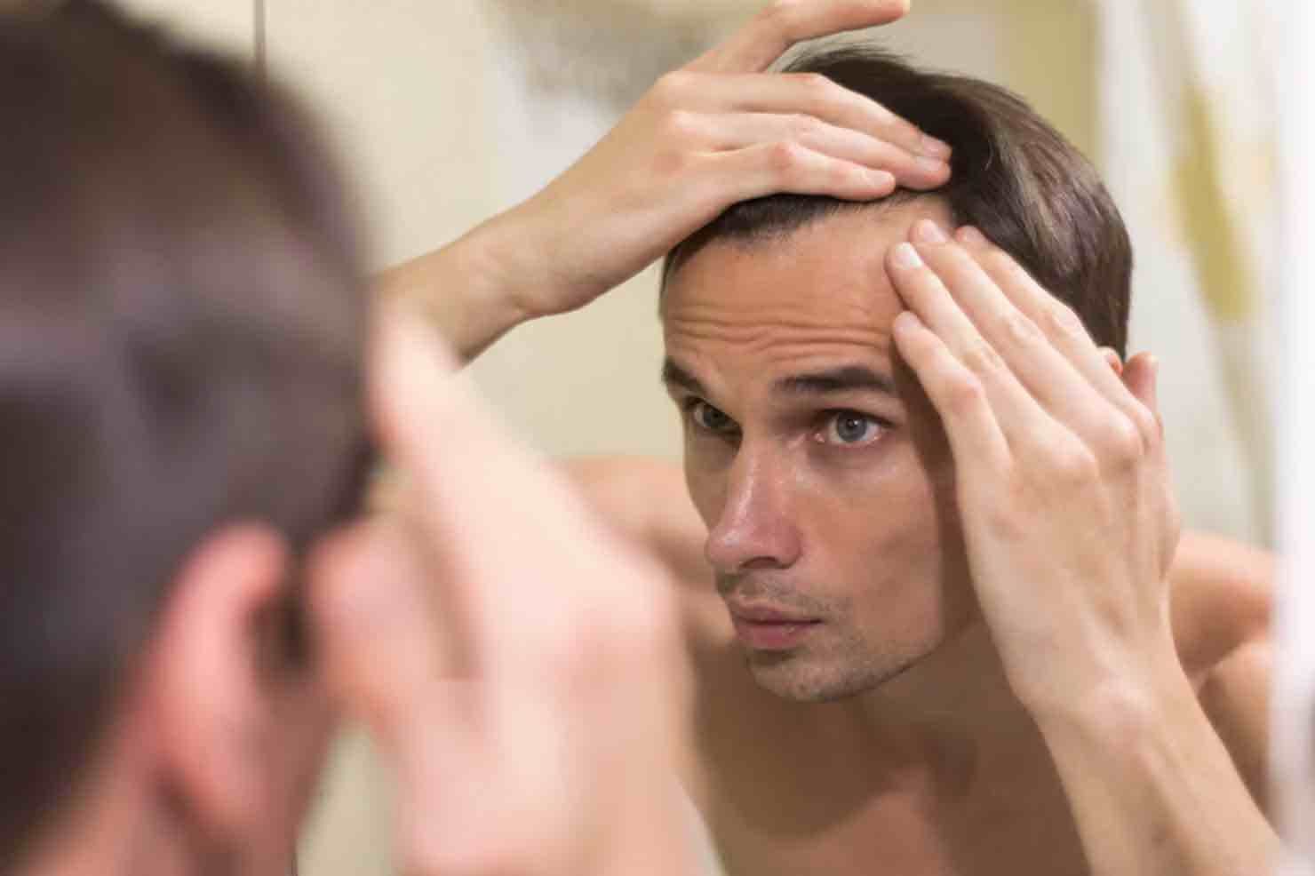 ¿A qué edad estás a salvo de la calvicie?