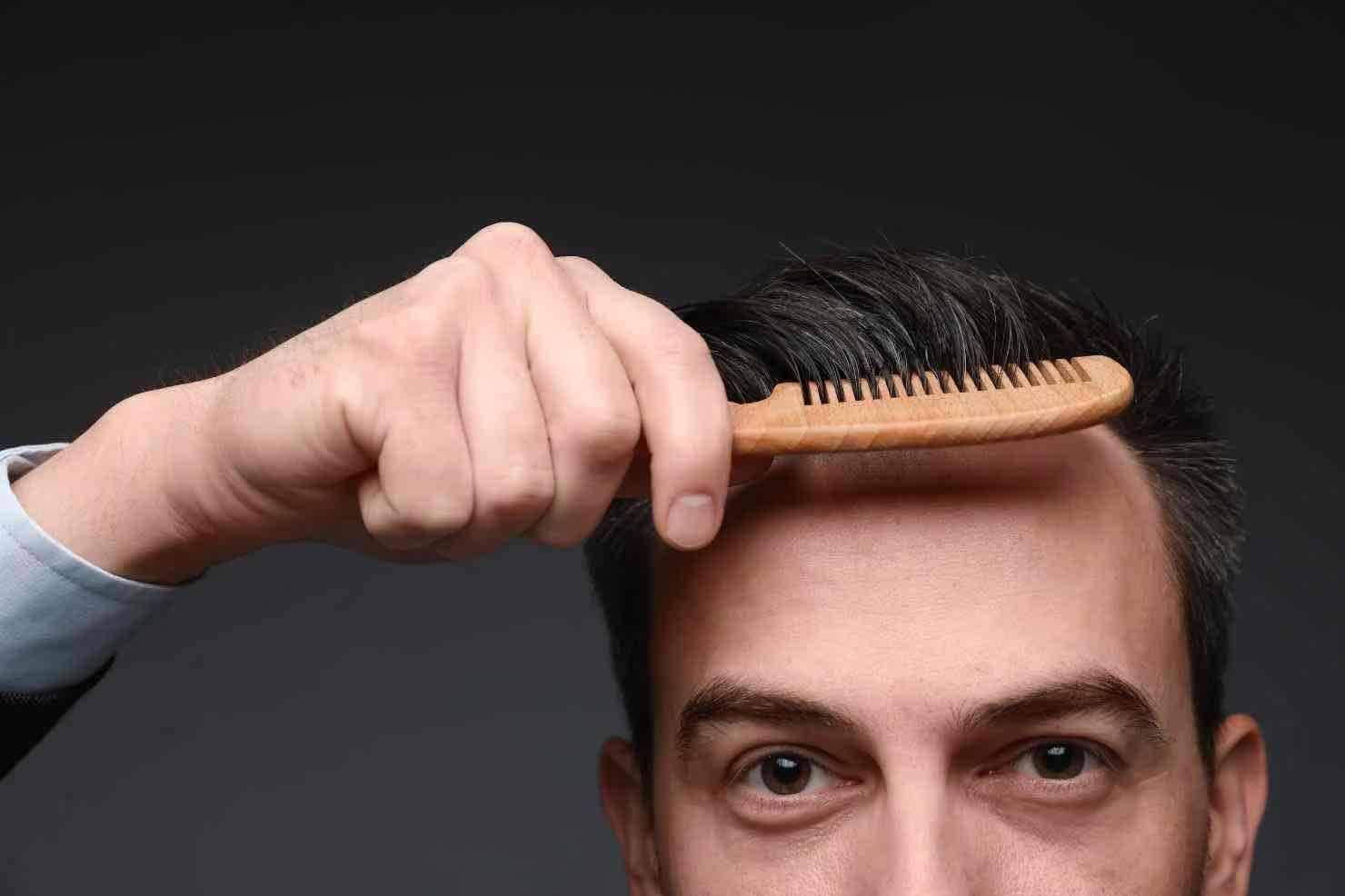 5 consejos clave antes de colocarte una prótesis capilar para hombre