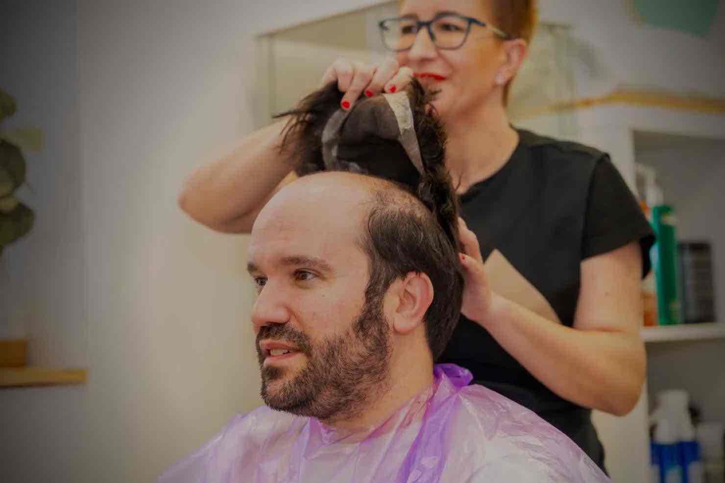 ¿Qué tipos de prótesis capilares existen?