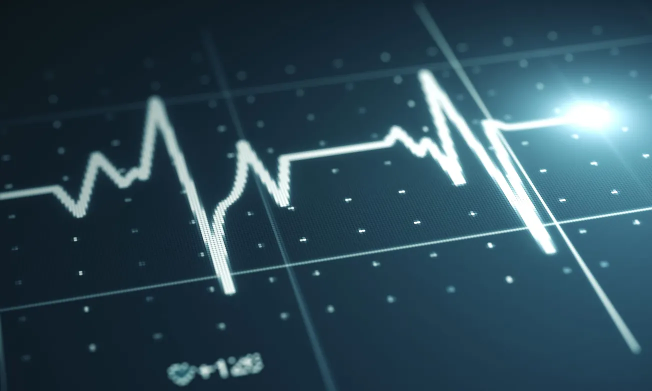 Bon Secours St. Mary’s Hospital becomes first in region to offer new AFib treatment