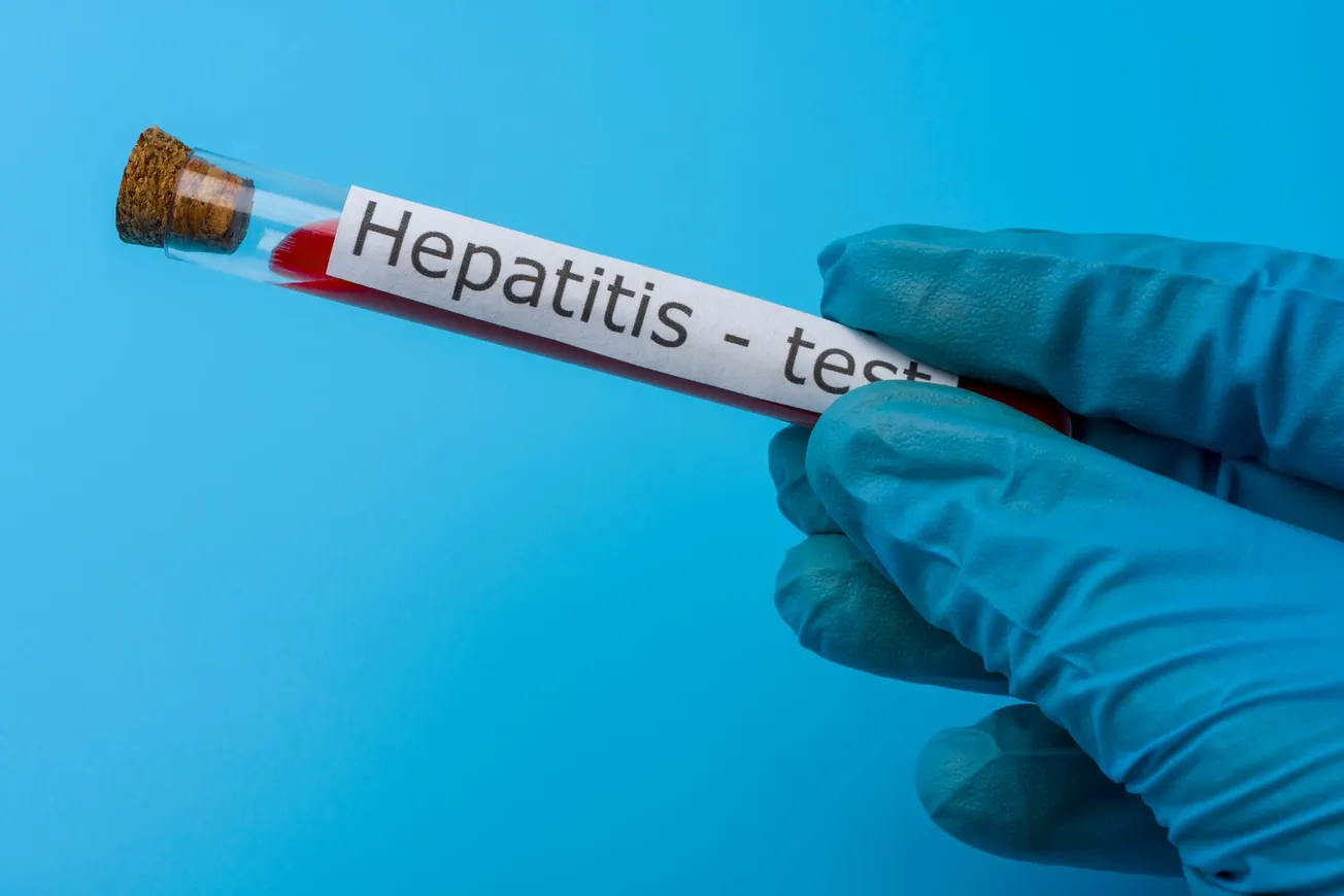 RHHD encourages hepatitis testing