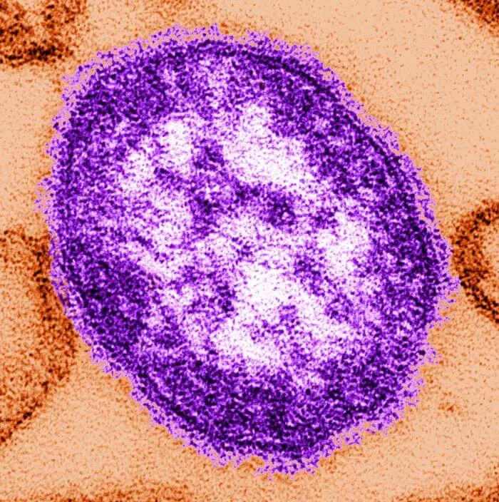 Public health officials warn of rise in measles, as Va. hantavirus patient under monitor