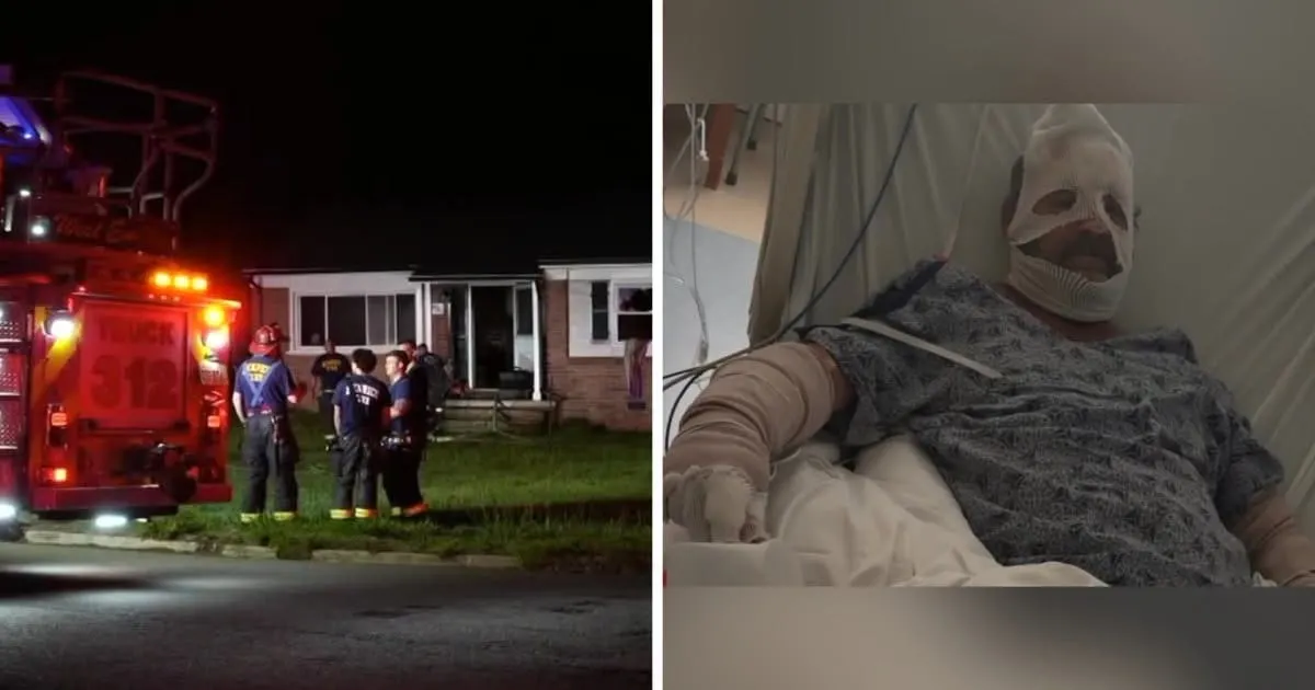 Henrico man survives house fire, says no smoke alarms were in rental home