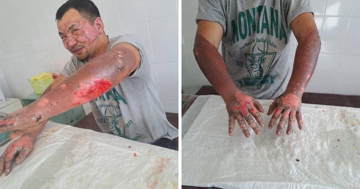 Пострадавший в аварии на ТЭЦ Бишкека просит о помощи – пока он не сможет вернуться к работе