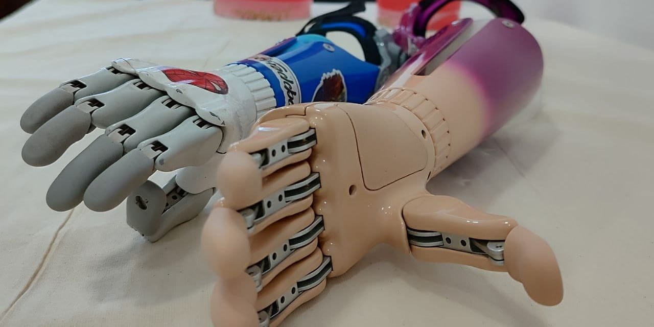 В 2025 году протезно-ортопедическую помощь получили 11.5 тысячи кыргызстанцев