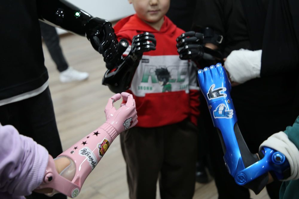 Бесплатные киберпротезы рук получили 13 детей из Кыргызстана изображение публикации