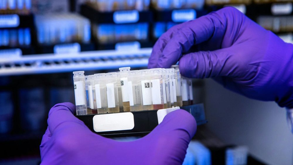 Республиканский центр крови закупит тест-системы и расходники на 17.7 млн изображение публикации