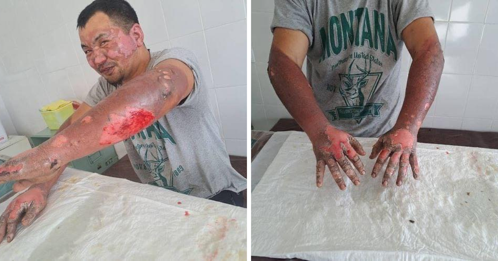 Пострадавший в аварии на ТЭЦ Бишкека просит о помощи – пока он не сможет вернуться к работе изображение публикации