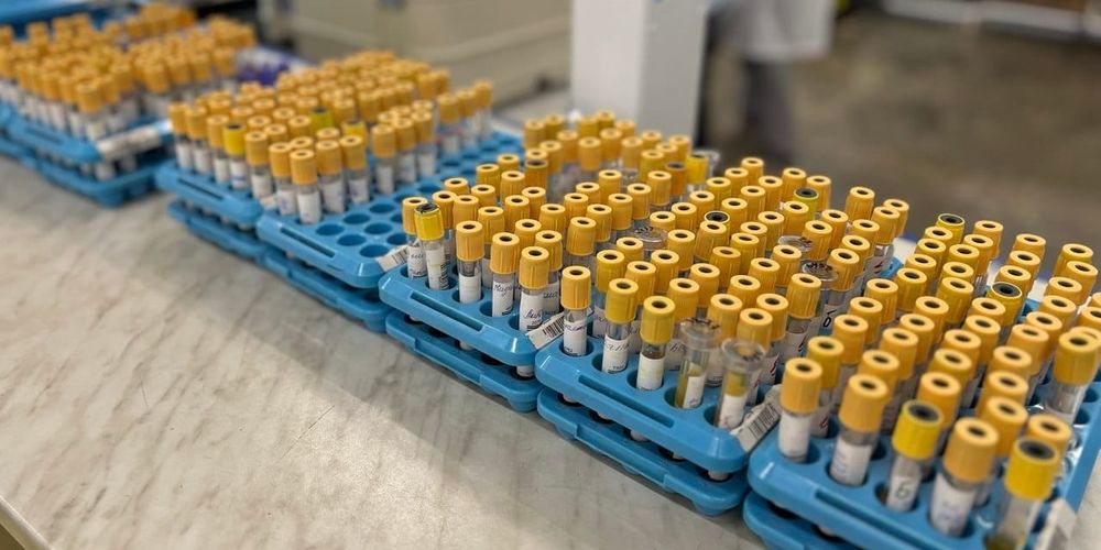 Минздрав планирует создать государственную референс-лабораторию в Бишкеке изображение публикации