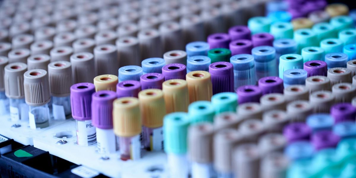 КГМА закупит оборудование для исследований лекарств на 98.2 млн сомов