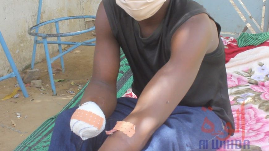 Tchad : Victime d’une explosion de grenade en sauvant les enfants, Djessandjin Augustin perd sa main droite et appelle à l'ai