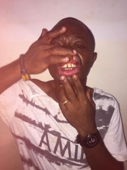 Cameroun : Un cameraman de Canal 2 molesté par des agents communaux de Yaoundé 5ème