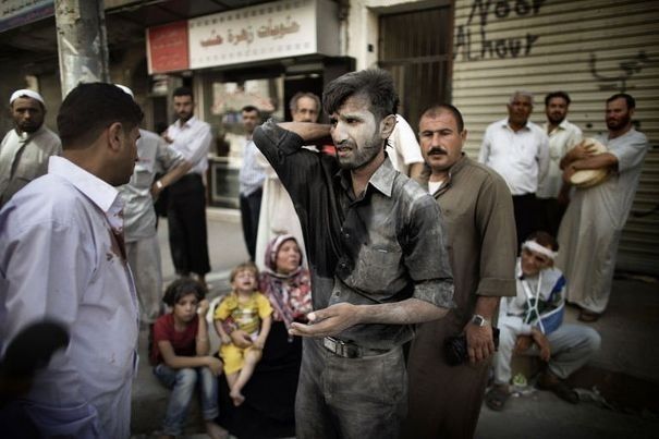 Le survivant d'une frappe aérienne arrive dans un hôpital d'Alep, en Syrie, le 18 septembre 2012 afp.com/Marco Longari