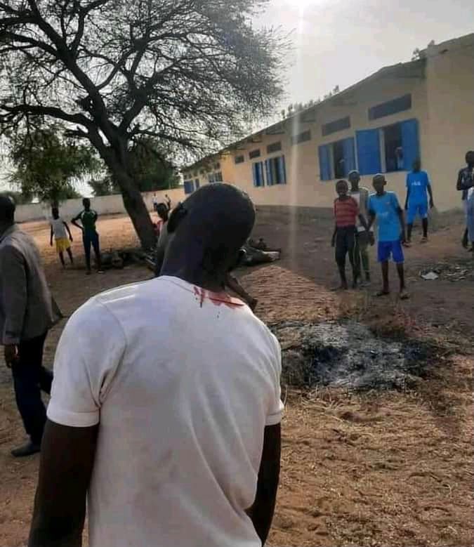 مدرس يتعرض للإصابة الخطيرة على كتفه ورأسه في البطحاء