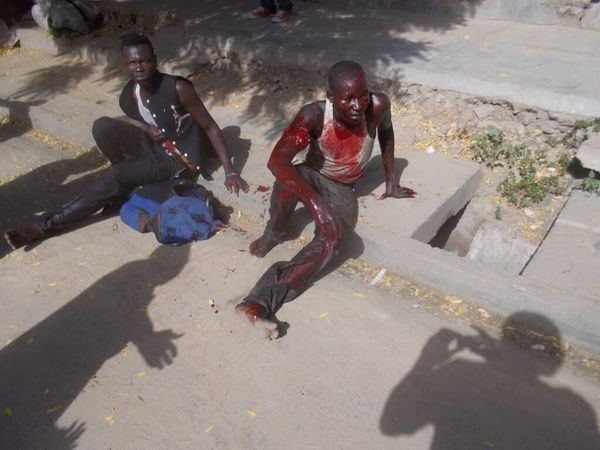 Tchad : les premières images des blessés de l'explosion