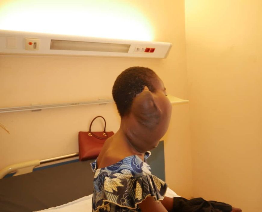 Tchad : une fillette atteinte d’une masse au cou admise au CHU La Renaissance