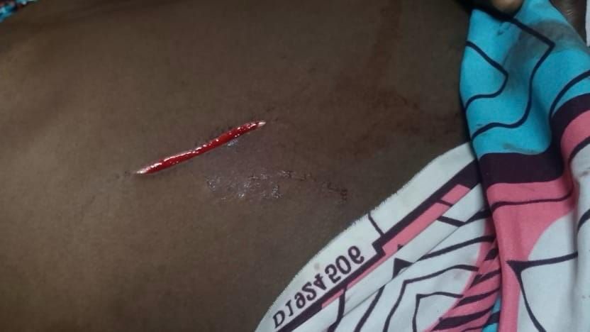 Violence conjugale à Moundou : une femme enceinte agressée par son mari