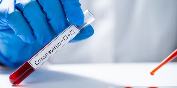 Togo : le gouvernement lance un passeport vaccinal pour les personnes vaccinées contre le Covid-19